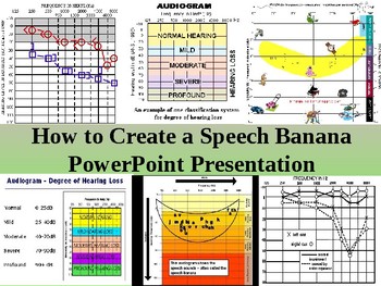 Asha Speech Banana Audiogram