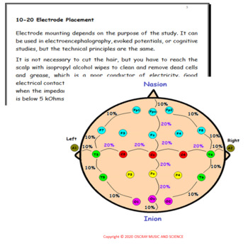 A new era in electroencephalographic monitoring? Subscalp devices for  ultra–long‐term recordings - Duun‐Henriksen - 2020 - Epilepsia - Wiley  Online Library