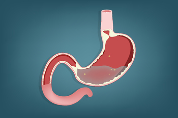Preview of A part of human organs: The stomach