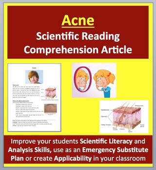 Preview of Acne - Science Reading Article - Grades 5-7