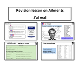 Ailments- J'ai mal- French lesson