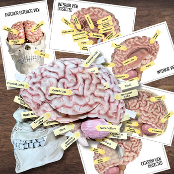 Preview of Anatomy HUMAN BRAIN - Anatomically Correct 2D Dissection Labeling Activity
