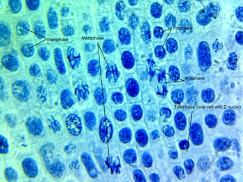 Preview of Annotated Onion Root Tip in Mitosis