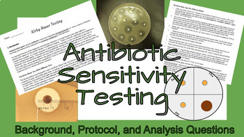 Preview of Antibiotic Sensitivity Testing (Kirby Bauer)