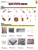 BLOOD SPATTER ANALYSIS