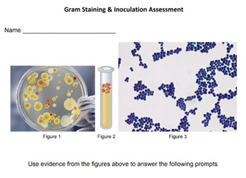 Preview of Bacterial Morphology, Gram Stain & Inoculation Assessment