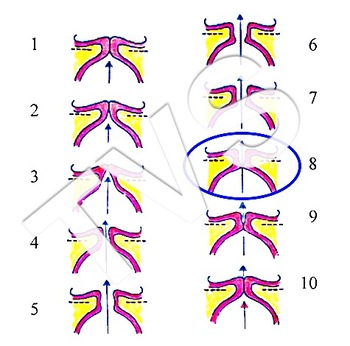 Preview of Bernoulli's Fold Closure illustration