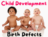 Birth Defects - Child Development
