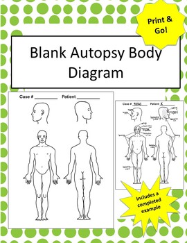 Preview of Blank Body Diagrams! Perfect for Forensics (Autopsy) or Anatomy! Print & Go