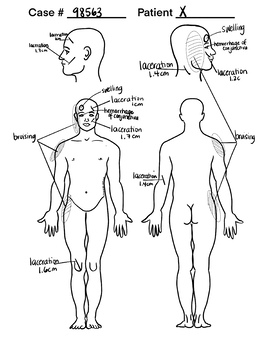 Blank Body Diagrams! Perfect for Forensics (Autopsy) or Anatomy