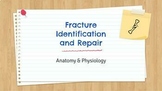 Bone Fracture Identification & Repair Activity