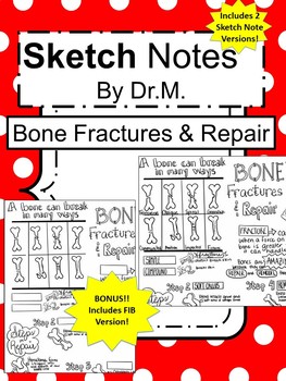 Preview of Bone Fracture & Repair Sketch Doodle Notes, Student Notes, incl FIB Version!