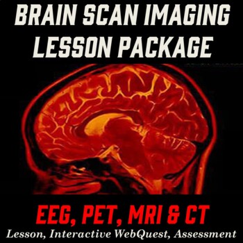 Preview of Brain Scan Imaging Webquest Lesson - EEG, PET, MRI, CT - Psychology