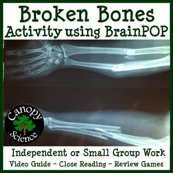 Broken Bones Worksheets Teaching Resources Teachers Pay Teachers - roblox broken bones 4 guide