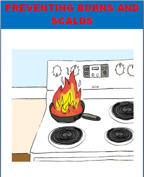 Preview of Burn and Scald Prevention/Safety- CDC Health Standard 5