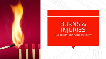 Preview of Burns and Skin Injuries PowerPoint (integumentary system; anatomy & physiology)