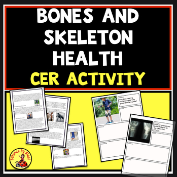Preview of CER  ACTIVITY BONE AND SKELETON HEALTH Informational Text, Graphic Organizers