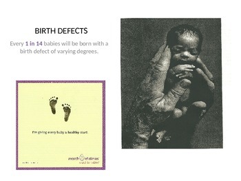 Preview of Child Development unit 2 day 2 power point Birth Defect factors-Don't Eat Pete
