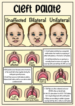 Preview of Cleft Lip/ Palate Visual Aid