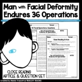 "Man with Facial Deformity Endured 36 Operations" Article 
