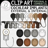 Cochlear Implants CLIP ART Deaf Hearing Loss Auditory Verb