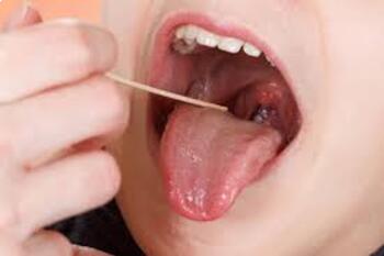 Preview of Nose and Throat Infections: Common Early Childhood Diseases: