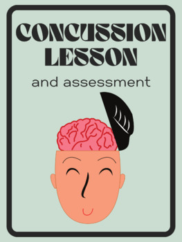 Preview of Concussion Lesson Plan and Assessment