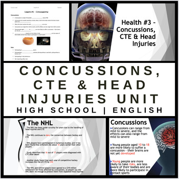 Preview of Concussions, CTE and Head Injuries - Complete Unit Bundle - Health - English