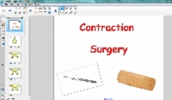 Preview of Contraction Surgery