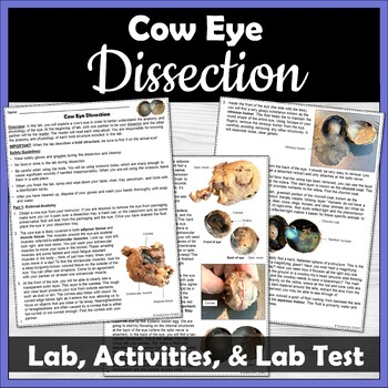 Preview of Cow Eye Dissection, Review Activities, and Lab Test