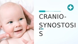 Craniosynostosis Presentation for SLP