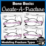 Create-A-Fracture - Hands-on Activity on Broken Bones and 