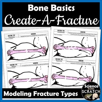 Preview of Create-A-Fracture: Broken Bones and Fracture Types Activity | Skeletal System