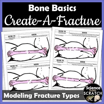 Preview of Create-A-Fracture: Broken Bones and Fracture Types Activity | Skeletal System