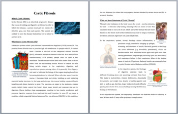 cystic fibrosis research paper outline