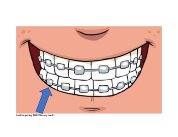 Preview of Dentist & Braces Social Story