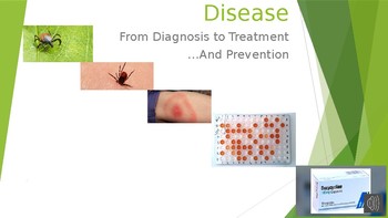 Preview of Diagnosis of Lyme disease