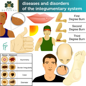 Preview of Diseases & Disorders Of The Integumentary System Clip Art