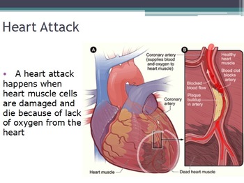 Preview of Diseases - Heart Disease (SMART BOARD)