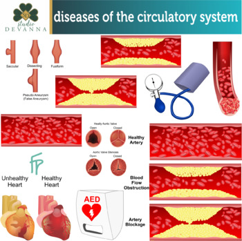 Preview of Diseases Of The Circulatory System Clip Art