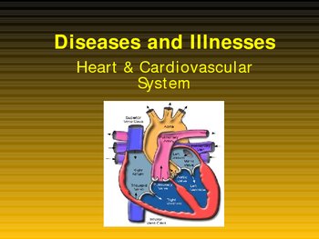 Preview of Diseases and Illnesses of the Circulatory / Cardiovascular System