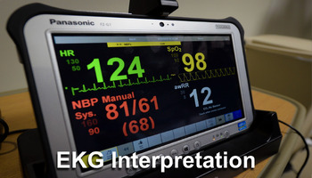 Preview of EKG Interpretation