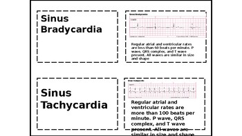 EKG Educational Cards