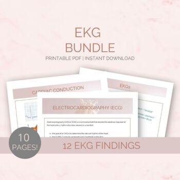Preview of EKGs Study Guide for Nursing Students | Interpreting | 12 Findings & Treatment