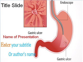 Preview of ENDOSCOPY POWERPOINT TEMPLATE