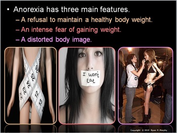 Preview of Eating Disorders Lesson, Anabolic Steroids