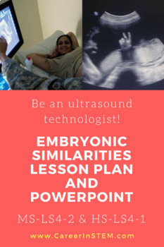 Preview of Embryonic Similarities Ultrasound Tech Lesson, Powerpoint, & Career Exploration