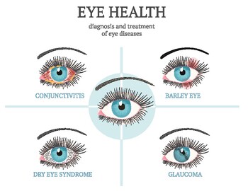 Preview of Eye disease ophthalmology health -  posters - letter size - Ready to print