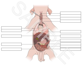 Ditki, Medical & Biological Sciences on X: Would you ratherread about  fetal circulation or draw it out? We'd choose drawing 100% of the time!  #ditki #meded #anatomy #embryology #humandevelopment #medicalschool  #nursing #pediatrics #