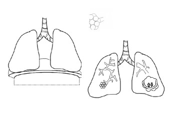 Preview of Foldable Lungs